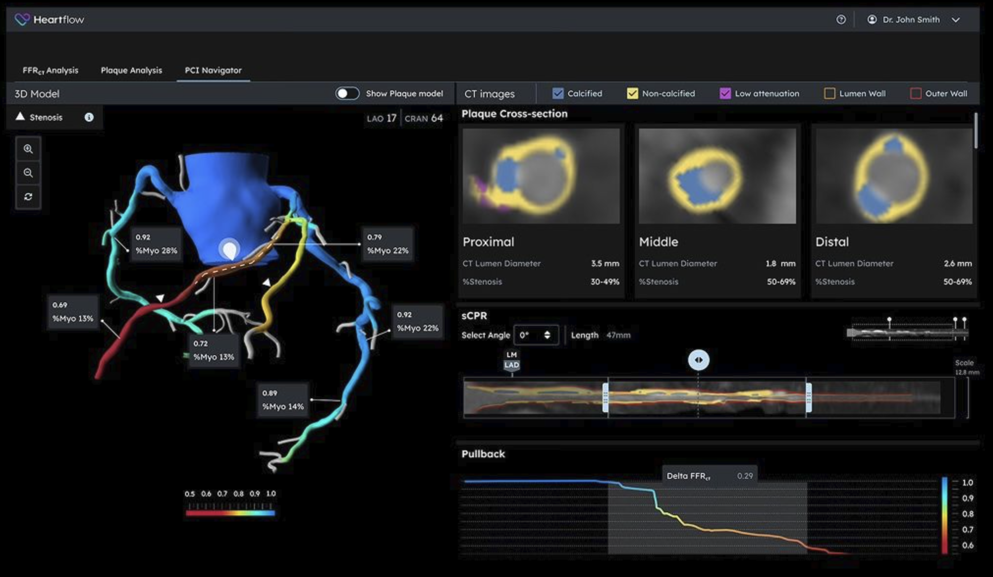 PCI navigator
